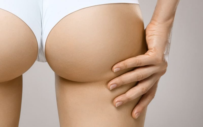 Complication Rates of Inner Thigh Lifts - Explore Plastic Surgery